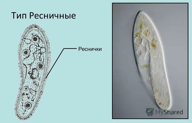 Передвижение инфузории. Ресничные инфузории (ciliata). Инфузория туфелька движение. Инфузория туфелька ресничк. Тип инфузории класс Ресничные.