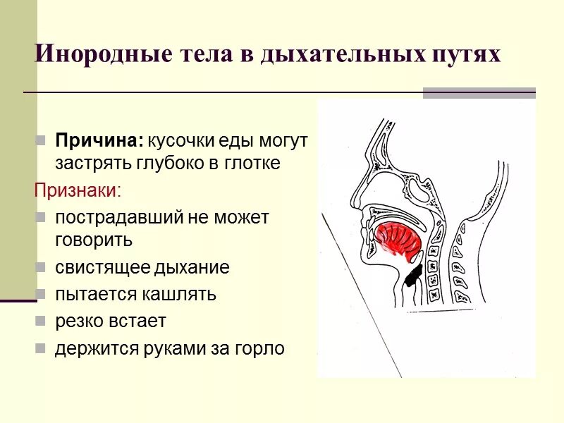 Инородные тела в глотке первая помощь. Инородное тело в дыхательных путях. Инородные тела верхних дыхательных путей. Перекрытие дыхательных путей инородным предметом. Попадание пищи в дыхательные пути.