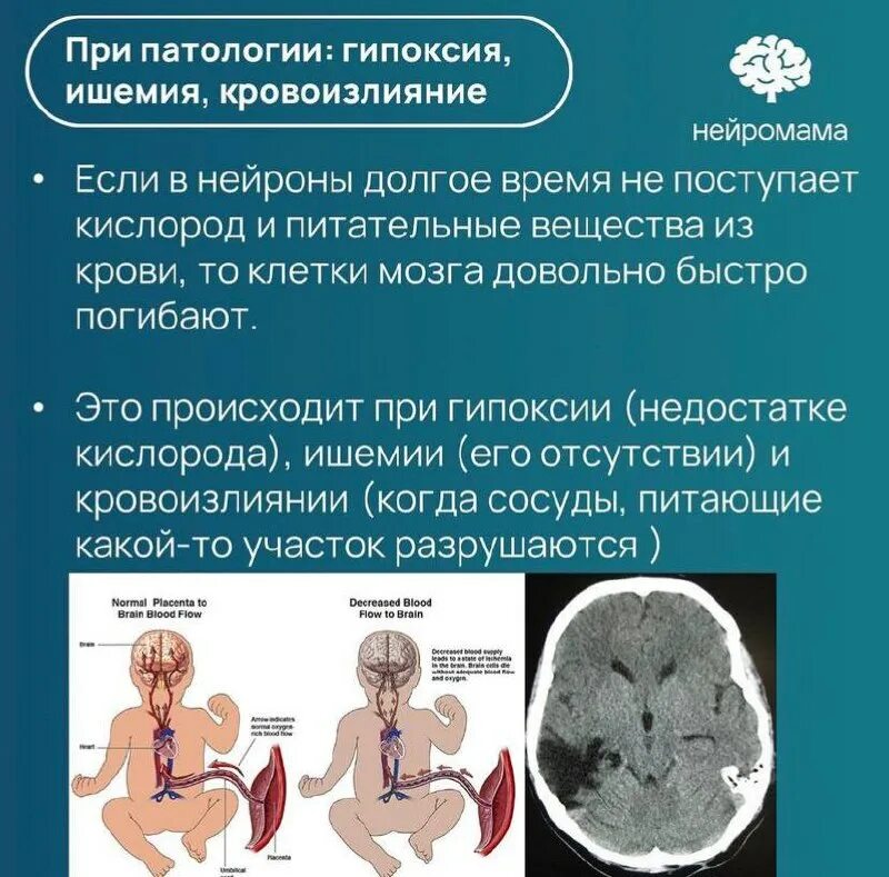 Нейромама