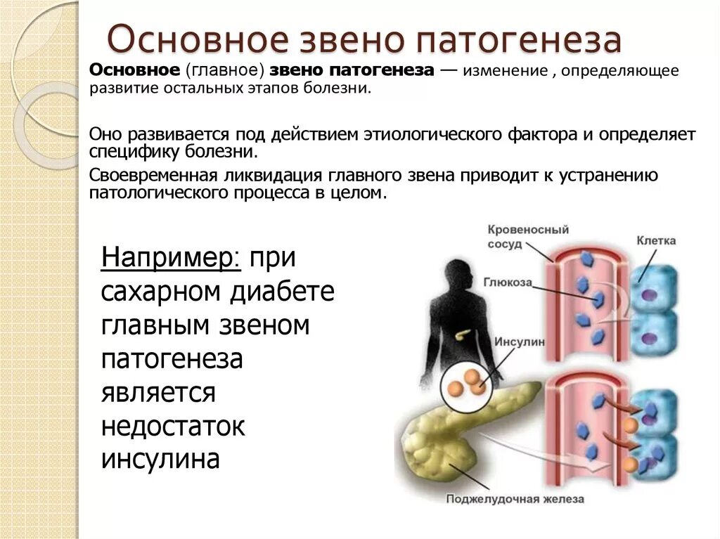 Основное заболевание пример. Основное звено патогенеза заболевания - это. Основное звено в патогенезе болезней. Основные звенья патогенеза. Начальное звено патогенеза.