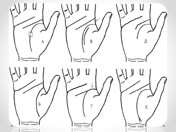 Линия ума и линия сердца на ладони. Линия симиан и линия жизни. Соединенная линия ума и сердца. Линия ума и сердца на руке. Линия головы.