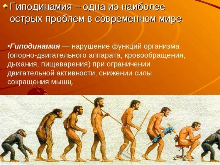 Гиподинамия. Гиподинамия болезнь. Гиподинамия болезнь века. Проблема гиподинамии. 5 гиподинамия