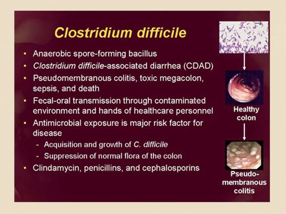 Клостридия диффициле Clostridium. Clostridium difficile натибиотик. Clostridium difficile микробиология. Clostridium difficile что это