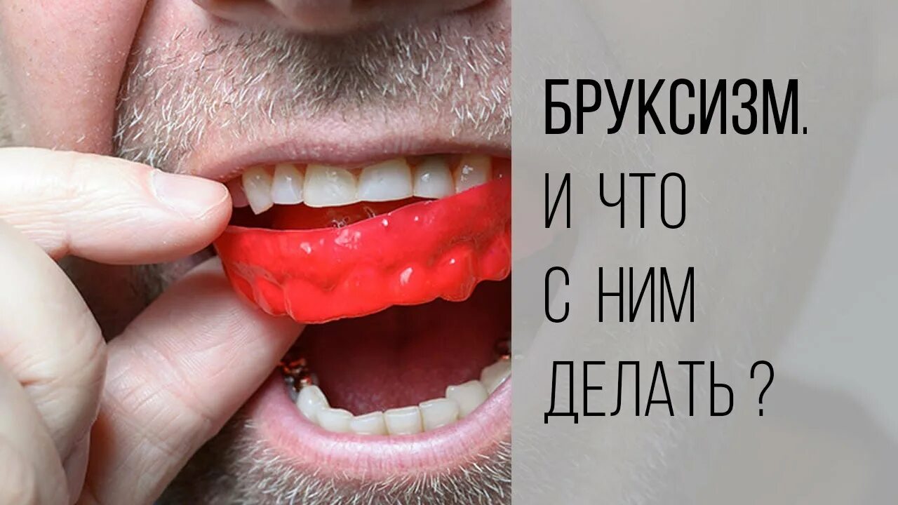 Бруксизм это что такое у взрослых. Бруксизм это что такое у взрослых