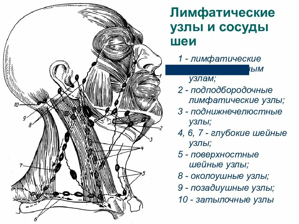 Глубокий лимфатический сосуд. Лимфатические сосуды и узлы шеи. Регионарные лимфатические узлы головы и шеи. Схема лимфоузлов на шее. Лимфатические сосуды головы и шеи схема.