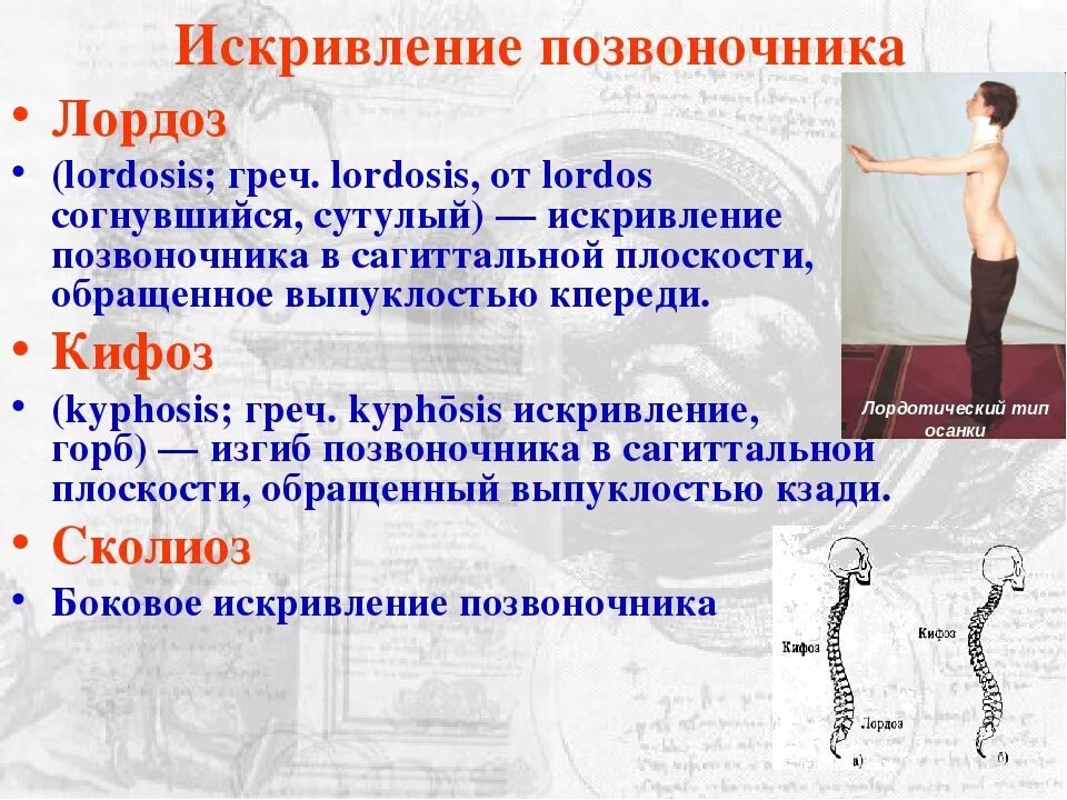 Нарушение осанки доклад. Таблица лордоз кифоз сколиоз. искривление позвоночника лордоз кифоз сколиоз. лордоз кифоз деформации позвоночника. нарушение осанки лордоз кифоз сколиоз.