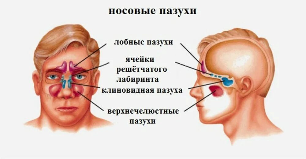 Киста верхнечелюстной пазухи 1.5. Киста клиновидной пазухи. Киста в носовой пазухе снимок. Истинные кисты верхнечелюстной пазухи. Утолщение слизистой оболочки решетчатых лабиринтов