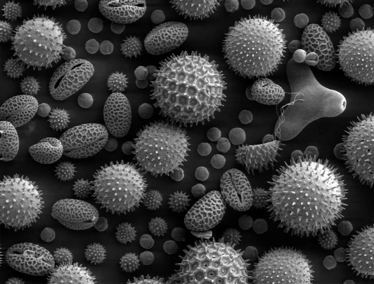 Как выглядит пыльца. Пыльца микроскопия атлас. Пыльца коронавирус под микроскопом. Пыльца микрофотографии. Пыльца подсолнечника под микроскопом.