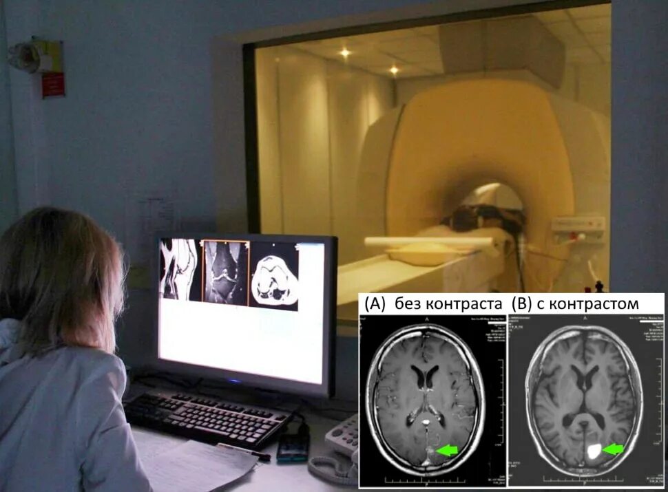 Мрт паническая атака. Мрт с контрастированием. Мрт с контрастом мрт 24. Компьютерная томография снимки. Снимок при компьютерной томографии.