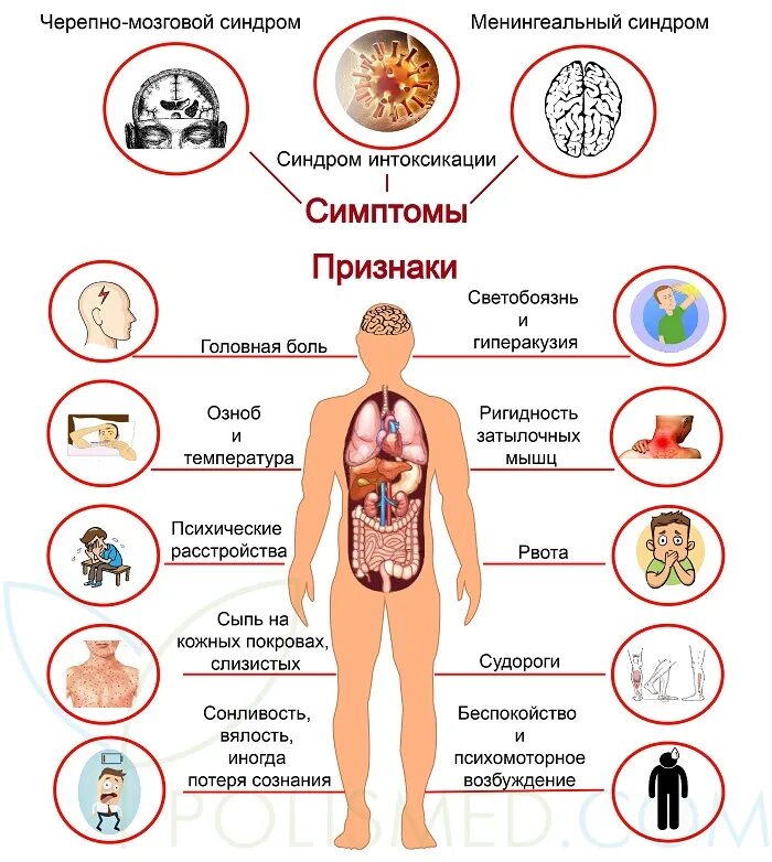 Симптомы менингита у человека. Проявления менингита симптомы. Воспаление мозговых оболочек симптомы.