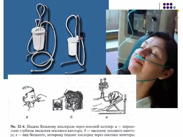 Через носовой катетер. Носовой катетер для оксигенотерапии с аппаратом Боброва. Аппарат Боброва для оксигенотерапии. Подача кислорода через носовой катетер аппарат Боброва. Аппарат Боброва для оксигенотерапии современный.