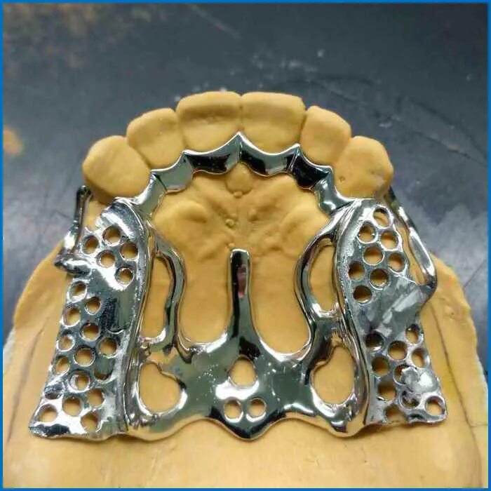 Литейка зуботехническая. Литье в стоматологии ортопедической. Литниковая система цельнолитого мостовидного протеза. Литники для бюгельного протеза. Зуботехническое литье.