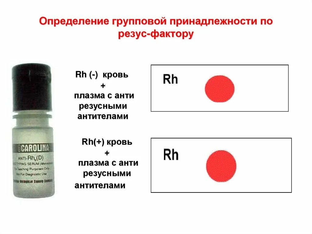 Цоликлон группа крови резус. Цоликлоны для определения резус фактора крови. Определить резус-фактор крови цоликлонами анти д. Цоликлоны анти резус. Группа крови ростов