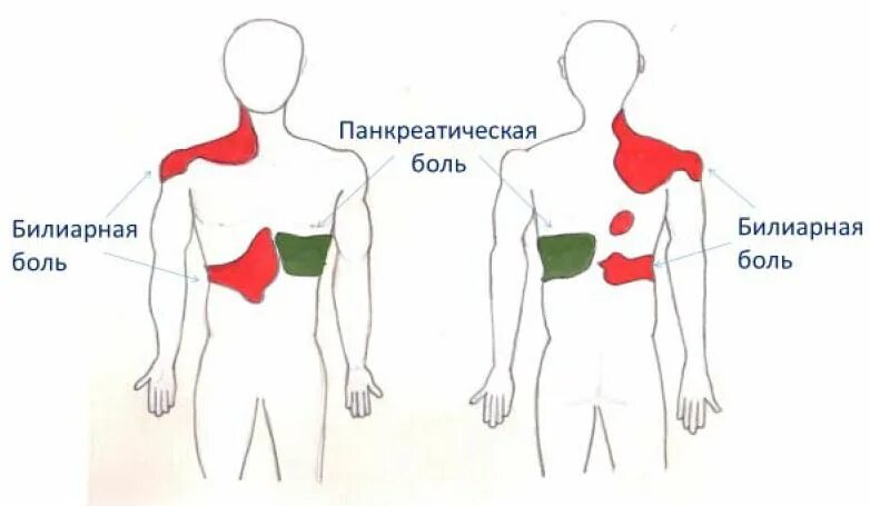 Может ли поджелудочная отдавать в спину