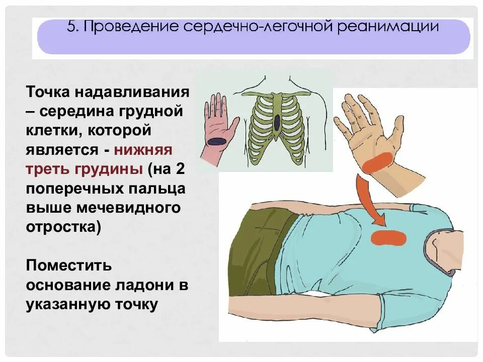 Алгоритм оказания первой помощи остановка дыхания и кровообращения. Алгоритм оказания первой медицинской помощи при остановке дыхания. Оказание 1 помощи при остановке дыхания кровообращения. Сердечно легочная реанимация надавливания на грудную клетку. Осложнения слр