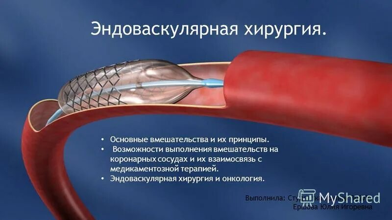 Нии кулакова эндоваскулярная хирургия. Рентген васкулярная хирургия. Рентген эндоваскулярная хирургия. Рентгенэндоваскулярная хирургия операции. Вмп эндоваскулярная хирургия.