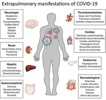 Инфекция covid 2019