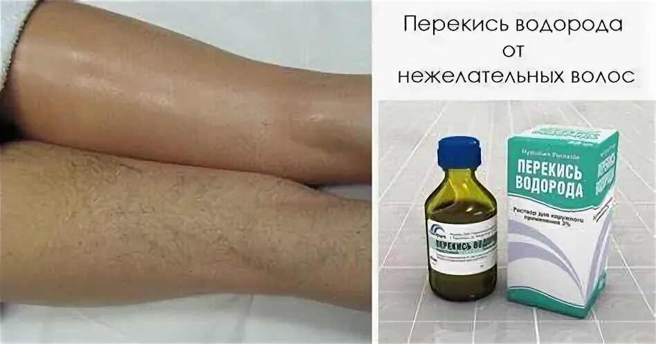 Пью перекись форум. Пью перекись форум