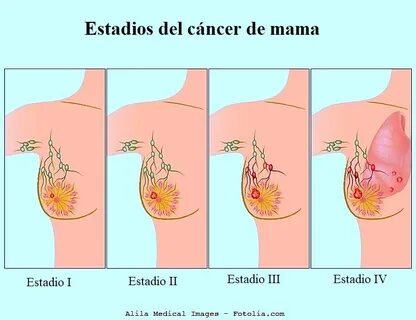 Mama de