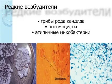 Атипичные микобактерии туберкулеза