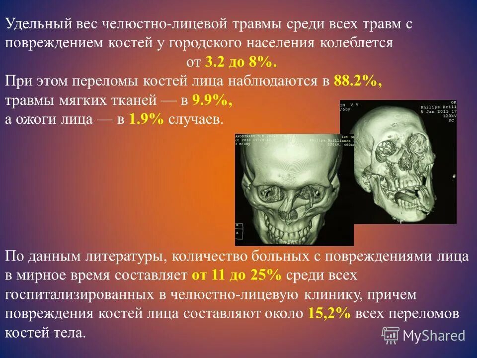 Ушиб челюстно лицевой области. График работ челюстно лицевой. График работ челюстно лицевой. График работ челюстно лицевой. Повреждение челюстно лицевой области медицинская помощь.