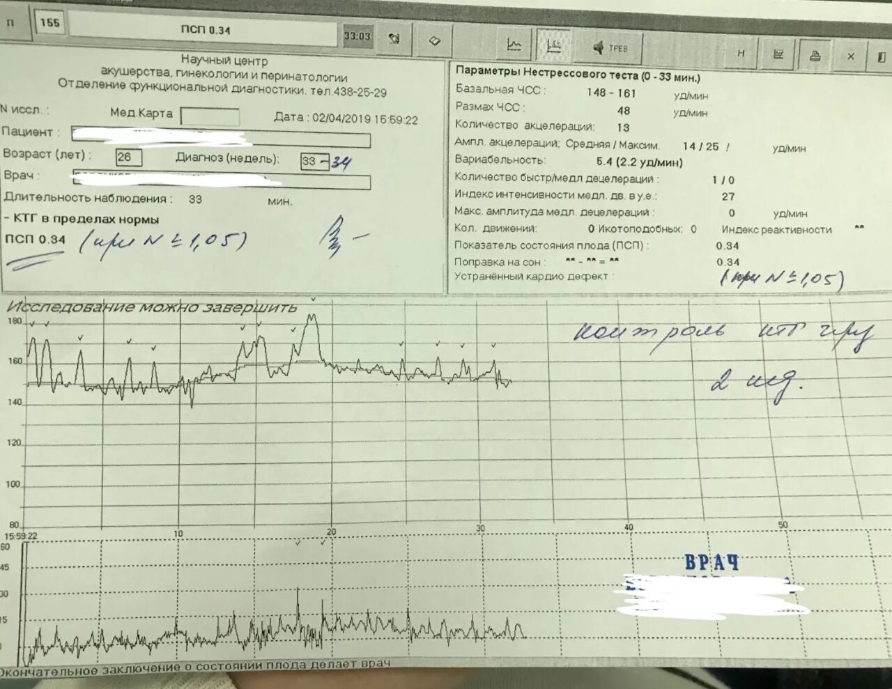 Схватки на 34. КТГ ПСП норма 36 недель. КТГ плода норма 33 недели беременности. Нормальные показатели КТГ плода. КТГ В норме при беременности 34 недели.