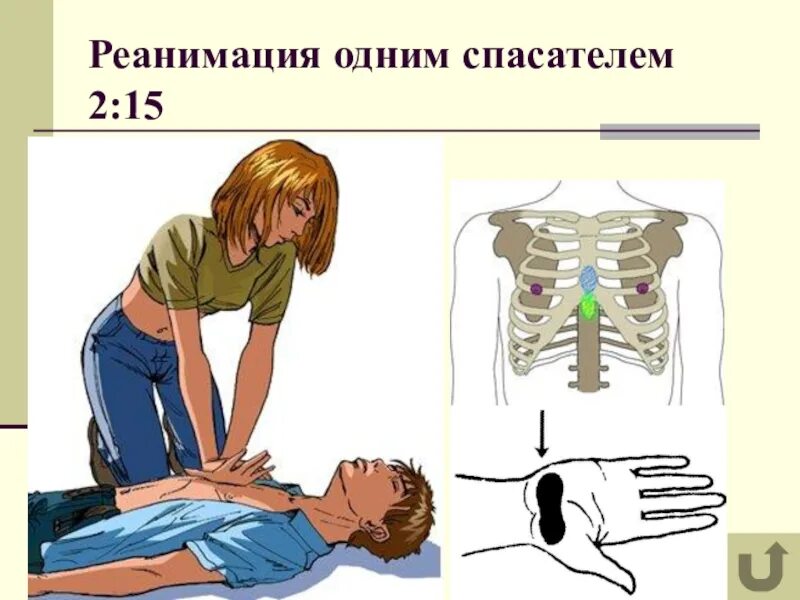 Сердечно легочная реанимация 1 спасателем. Проведение сердечно-легочной реанимации двумя спасателями. Проведение сердечно-легочной реанимации одним спасателем. Сердечно-легочная реанимация одним спасателем. Реанимационные мероприятия одним спасателем