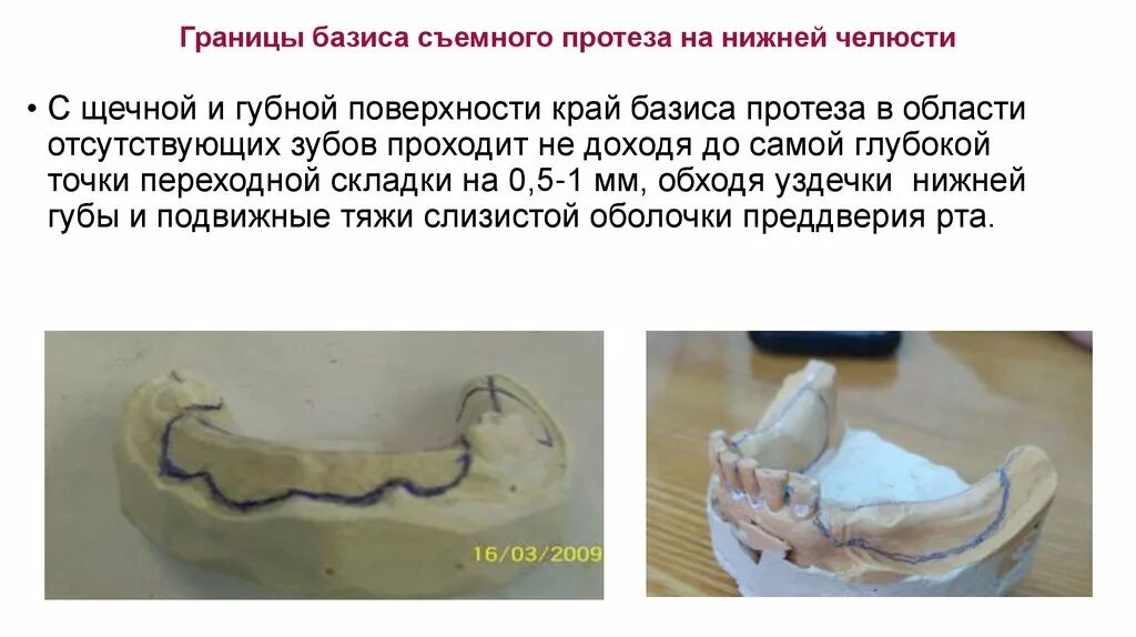 Привести в базисы. Границы базиса ЧСПП на нижней челюсти. Граница базиса протеза на нижней челюсти. Границы базиса съемного протеза на нижней челюсти. Границы базиса протеза на верхней челюсти.