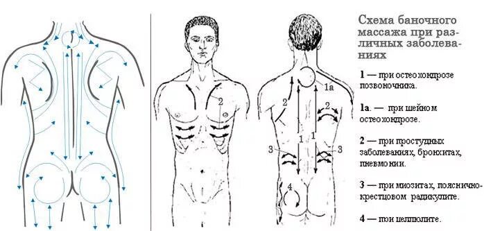 Сколько времени держать банки на спине. Вакуумный баночный массаж спины схемы. Вакуумный массаж спины схема. Массаж банками вакуумными для спины схема. Баночный массаж спины схема.