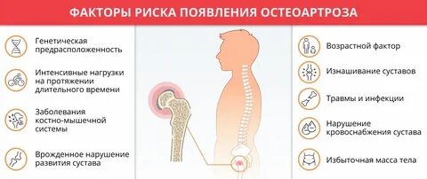 1 признаках остеоартроза