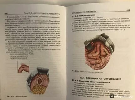 Анатомия островерхов