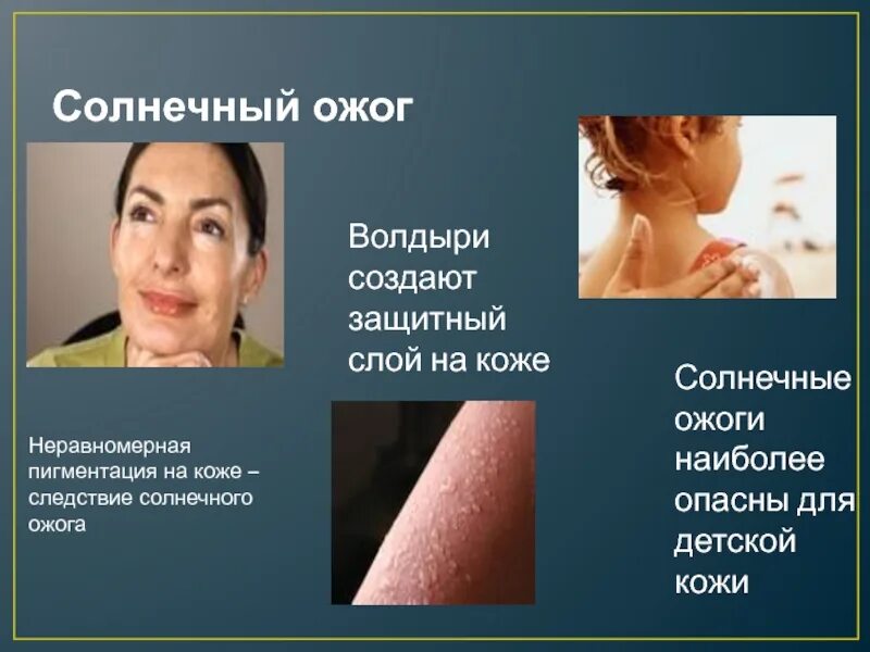 Заболевание кожи 8 класс кратко. Заболевания кожи презентация. презентация на тему кожные заболевания. повреждения и заболевания кожи.