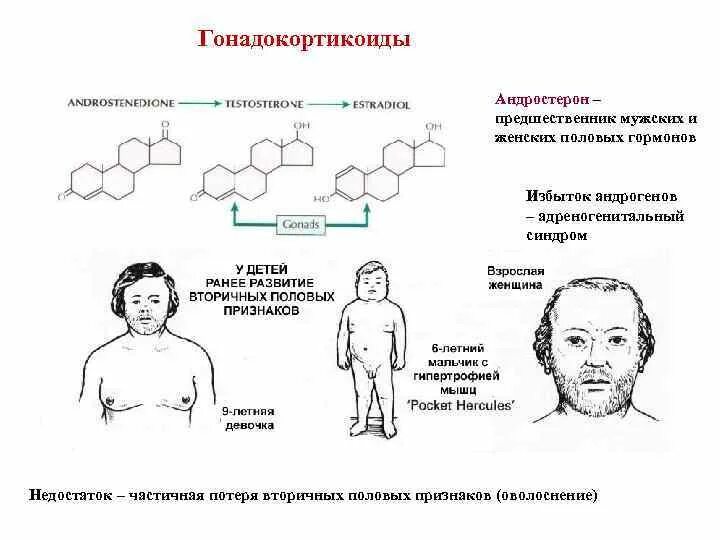 Адреногенитальный синдром клиническая картина. Тип наследования болезни адреногенитальный синдром. Врожденная дисфункция коры надпочечников картинки. Избыток половых гормонов. Без гормонов роста