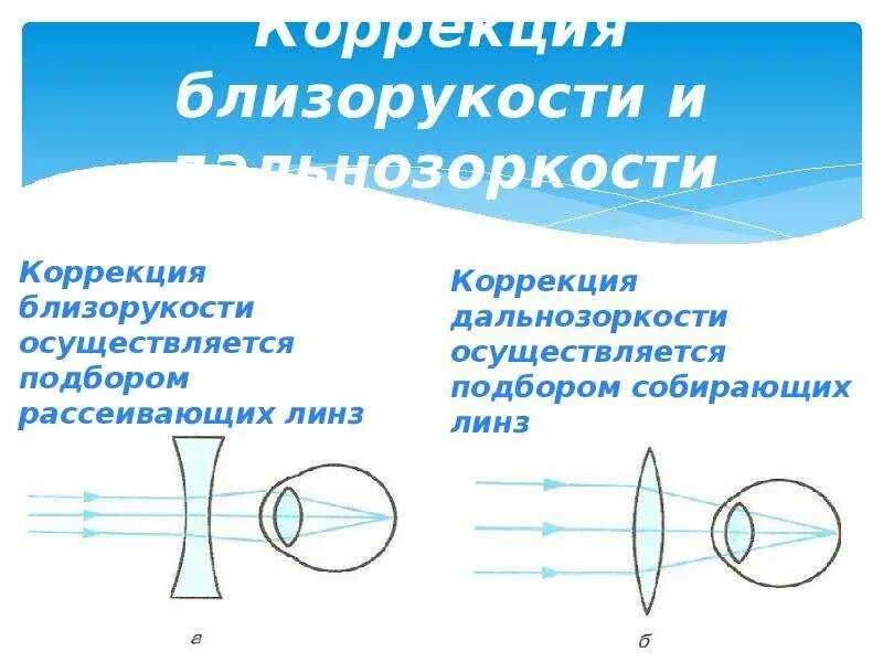 Дальнозоркость схема физика. Собирающая линза и рассеивающая линза. Зрительная система дальнозоркость линзы. Зрение схема близорукость и дальнозоркость. Оптическая линза физика 8 класс