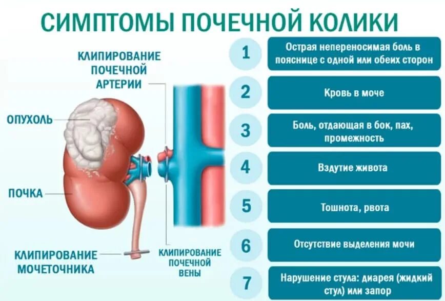 Что может привести к инфекционному заболеванию почек