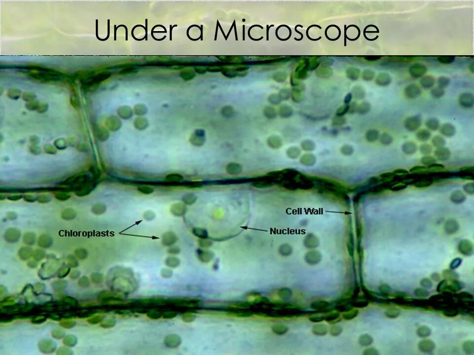 Хлоропласты в устьицах. Клетки элодеи в микроскопе. Клетки растения Элодея под микроскопом. Клетка элодеи под микроскопом. Элодея микроскоп.