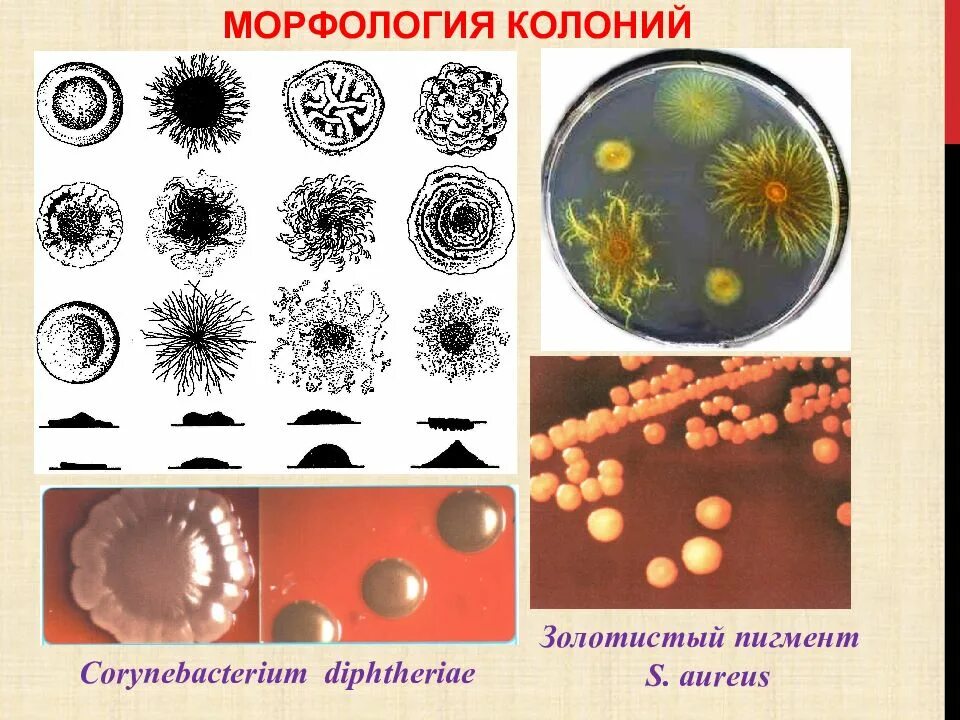 S форма бактерий. S формы колоний микробиология. Формы колоний бактерий r s. Формы колоний микроорганизмов. Морфология колоний микроорганизмов.