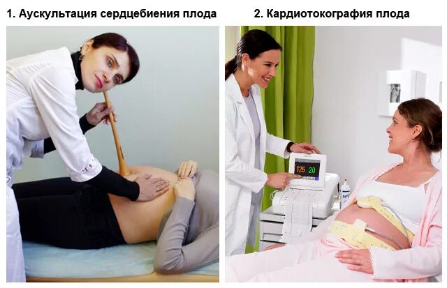 Виды сердцебиения плода. Выслушивание сердцебиения плода стетоскопом. выслушивание сердцебиение плода норма. аускультация сердцебиения плода. аускультация беременных.