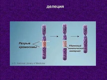 Потеря участка 4 хромосомы