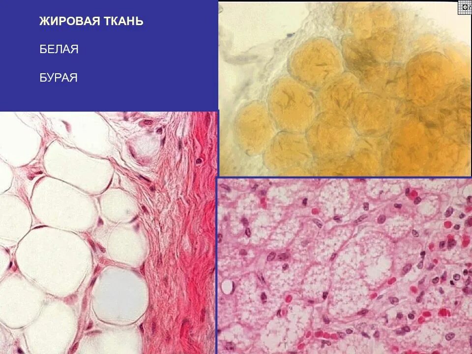 Бурая жировая ткань. Жировая ткань строение гистология. Жировая ткань это соединительная ткань. Белая жировая соединительная ткань.