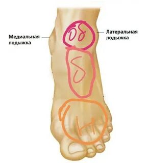 Отек медиальной лодыжки