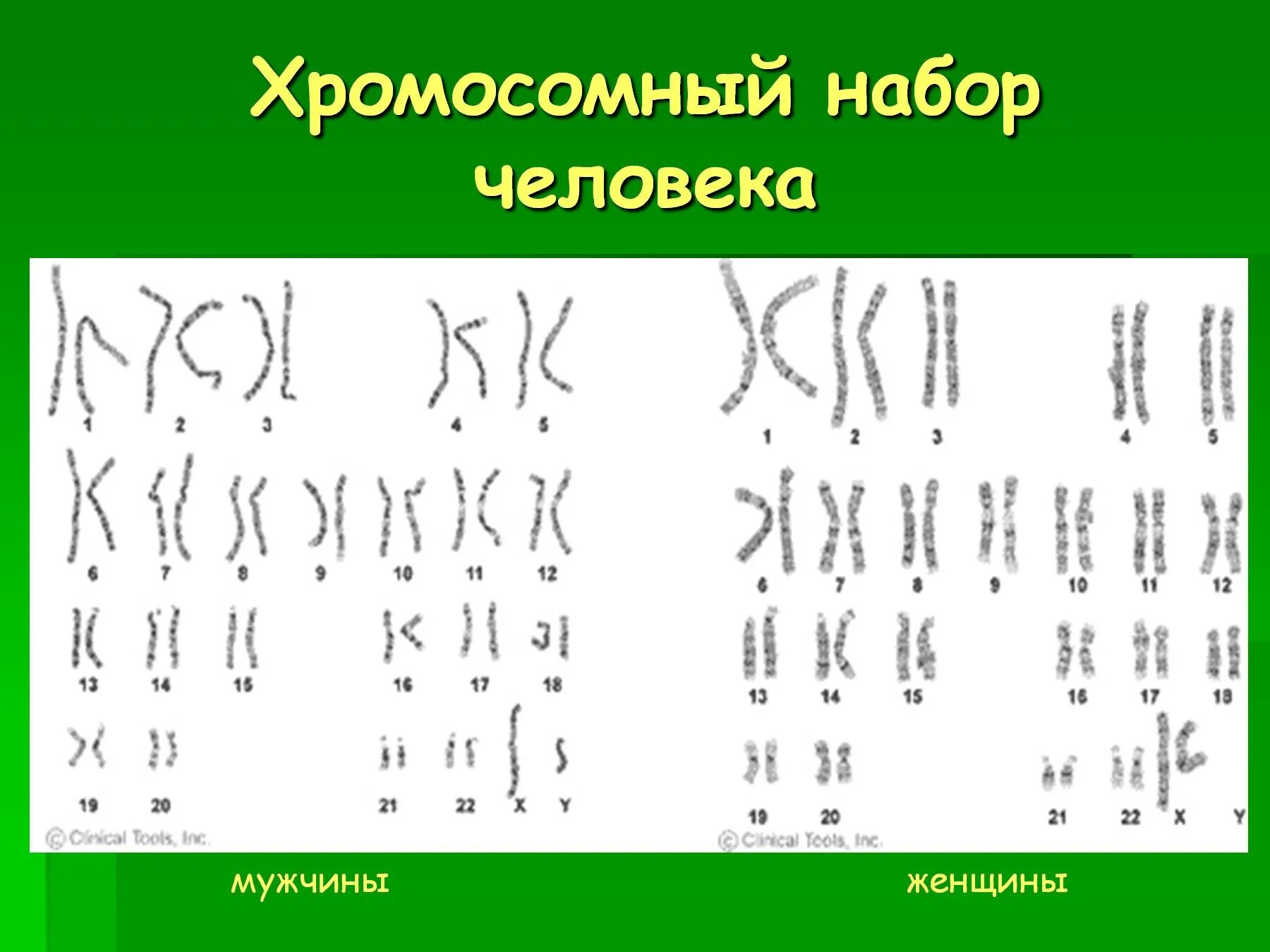 Хромосомный набор человека. Хромомсомныйнабор человека. Хромосомный набор человека мужчины и женщины. Хромосомный набор женщины.