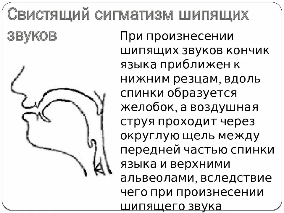 Щечный сигматизм. Профили артикуляции свистящих звуков. Межзубный сигматизм шипящих звуков. Нижний сигматизм шипящих. Ш как произносится