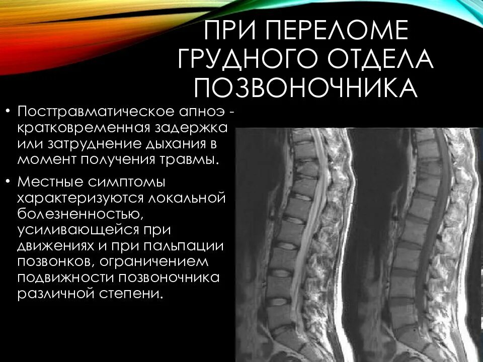 Компрессионный перелом позвоночника у взрослых. Перелом 11 позвонок грудного позвоночника. перелом позвонка грудного отдела симптомы. компрессионный перелом в грудном отделе позвоночника клиника. 7 позвонок грудного отдела компрессионный перелом.