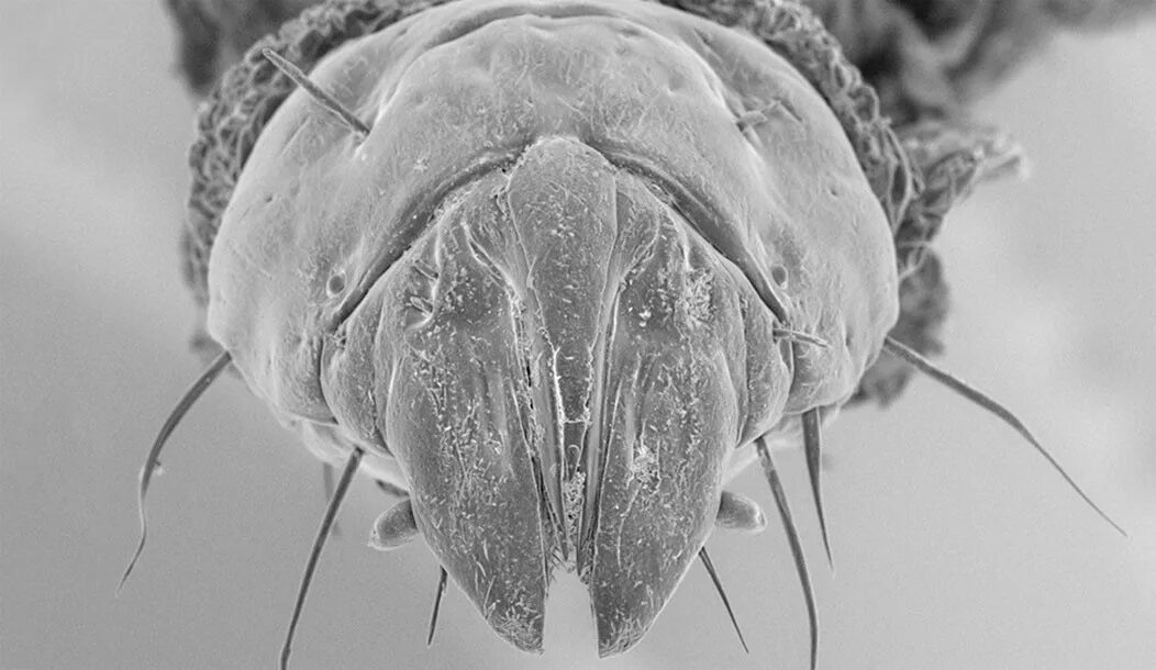 Насекомое трубочка. Личинка Стрекозы под микроскопом. Насекомые личинки под микроскопом. Мухи убийцы.