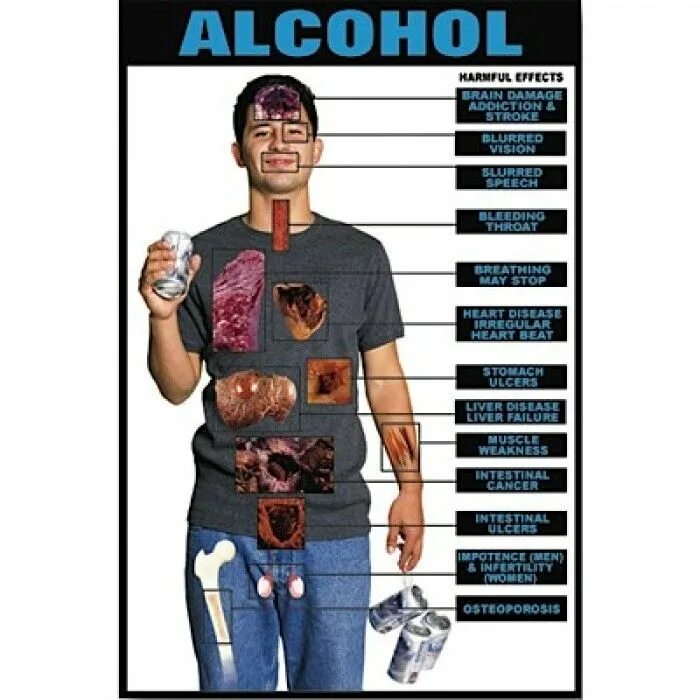 Alcohol Damage to the Brain.