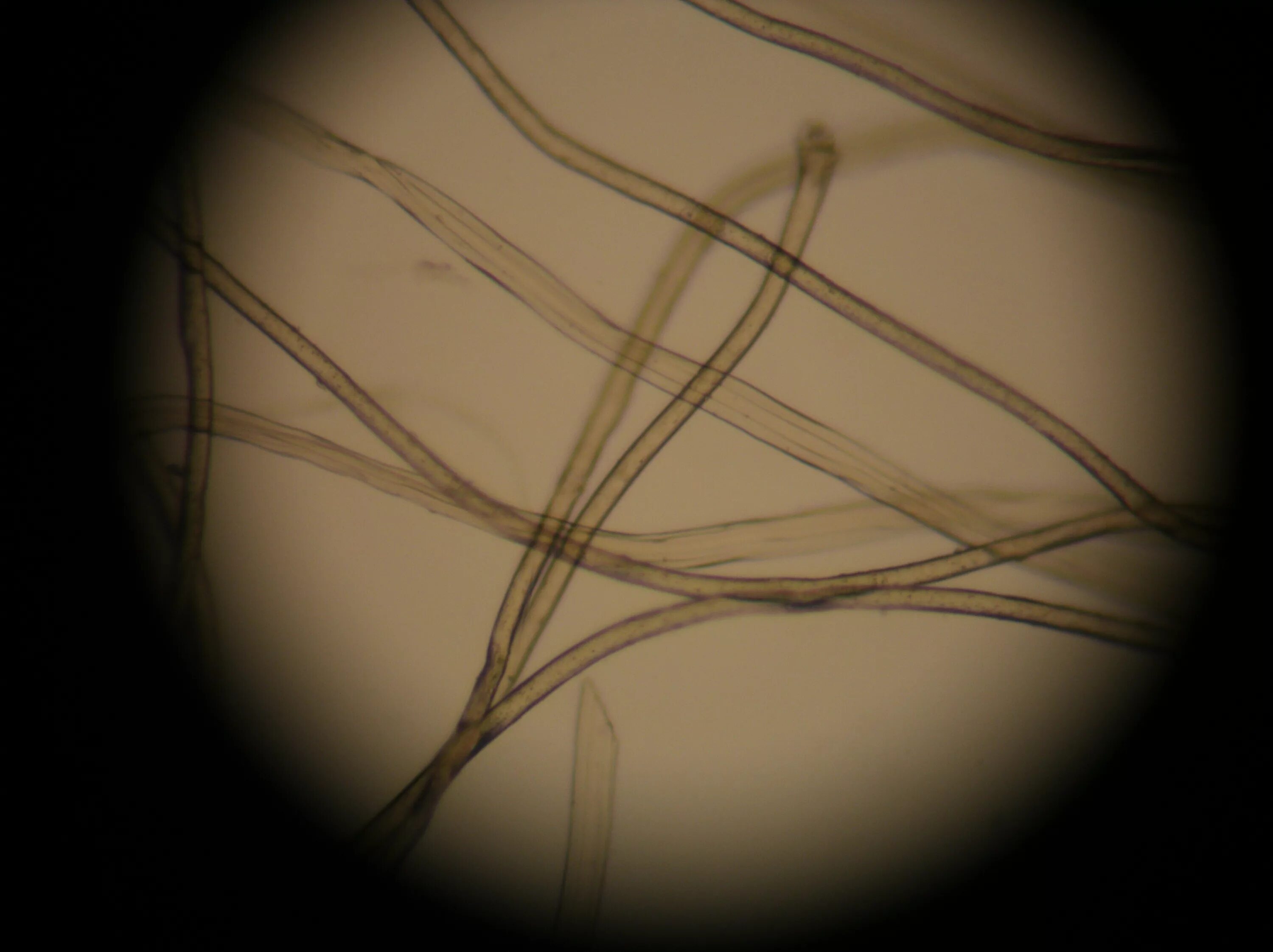 Микроскопия кала детрит. Мышечные волокна с исчерченностью в микроскопии кала. Лавсан волокно под микроскопом. Волокно хлорин под микроскопом. Методы исследования волокон.