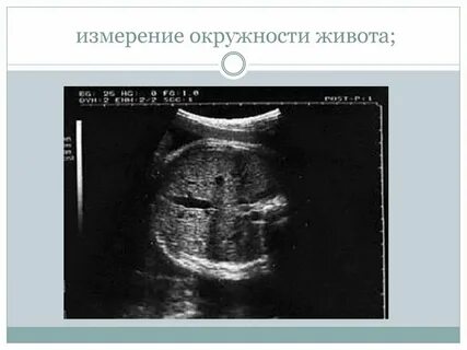 Желудок плода