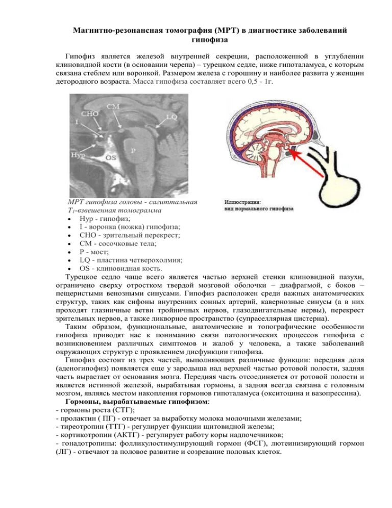 Анатомия турецкого седла и гипофиза. Мрт головного мозга заключение турецкое седло. Аденома гипофиза кт. Мрт гипофиза турецкое седло с контрастом.