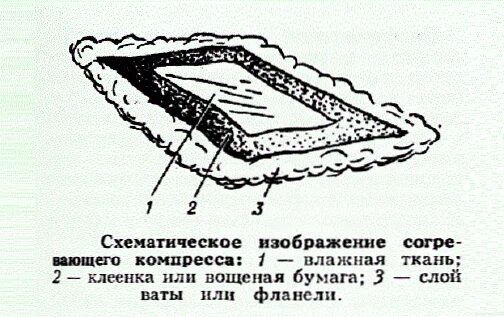 Техника наложения компресса. Спиртовой компресс. Согревающий компресс. Слои компресса спиртового. Согревающий компресс состоит.
